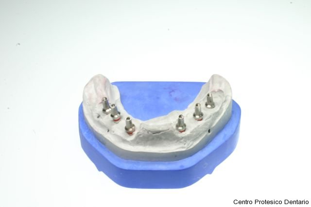 centro_protesico_dentario_lavorazioni14