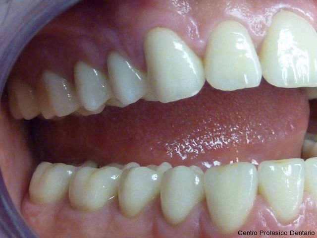 centro_protesico_dentario_lavorazioni34