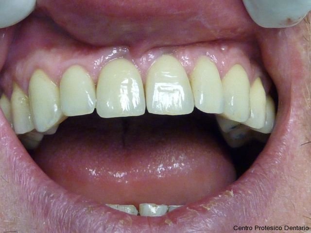 centro_protesico_dentario_lavorazioni41