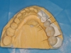 centro_protesico_dentario_lavorazioni16