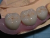 centro_protesico_dentario_lavorazioni23