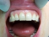 centro_protesico_dentario_lavorazioni29