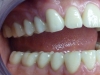 centro_protesico_dentario_lavorazioni34