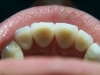 centro_protesico_dentario_lavorazioni38