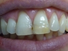 centro_protesico_dentario_lavorazioni39